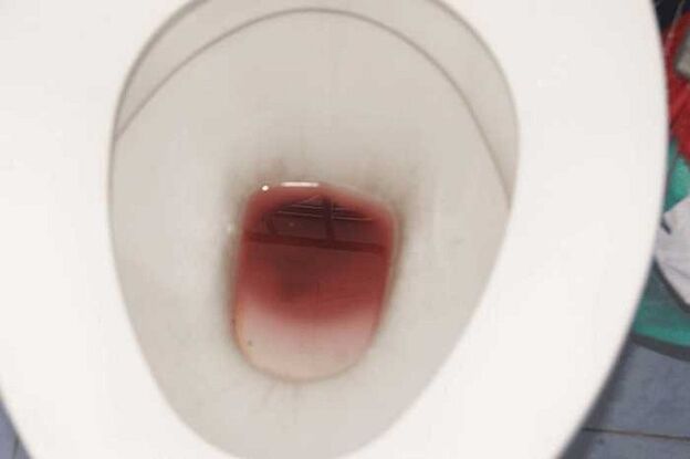 پرجوش ہونے پر مردوں میں اسپاٹ کرنا